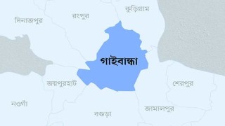 স্বামীর গায়ে গরম পানি ঢেলে ঝলসে দিল স্ত্রী